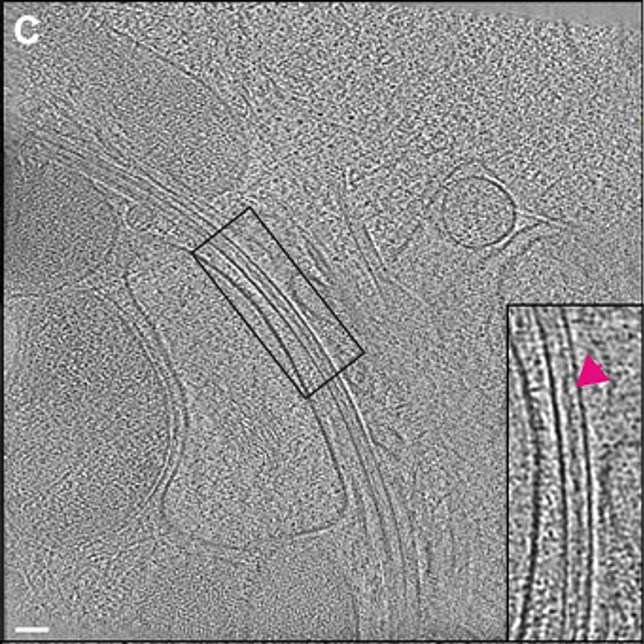 CryoET reveals actin filaments within platelet microtubules